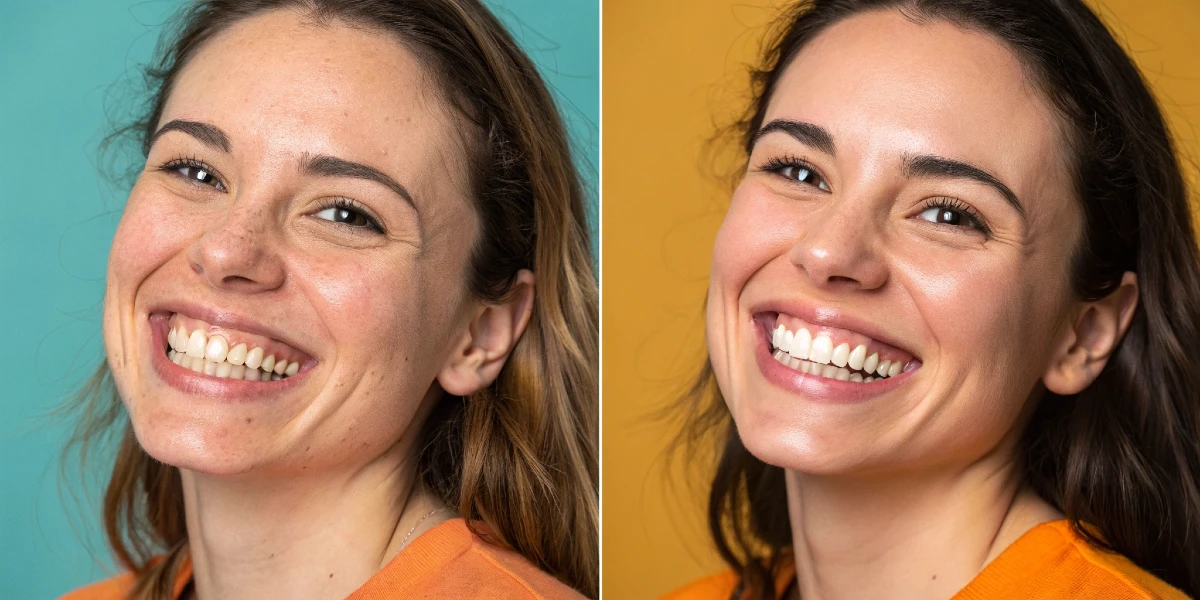 Before and after comparison of a patient receiving a smile makeover | Dr. Mariano Estrada, DDS, Santo Domingo, Dominican Republic